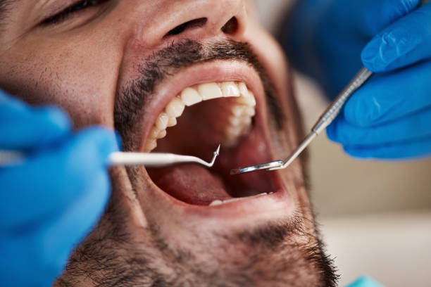 Best Emergency Treatment for Oral Infections in Cheval, FL