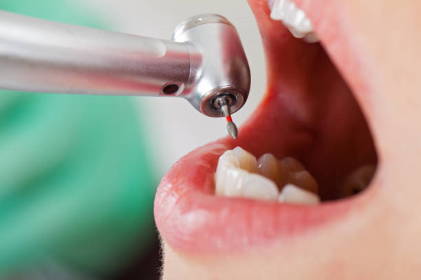 Best Emergency Denture Repair in Cheval, FL